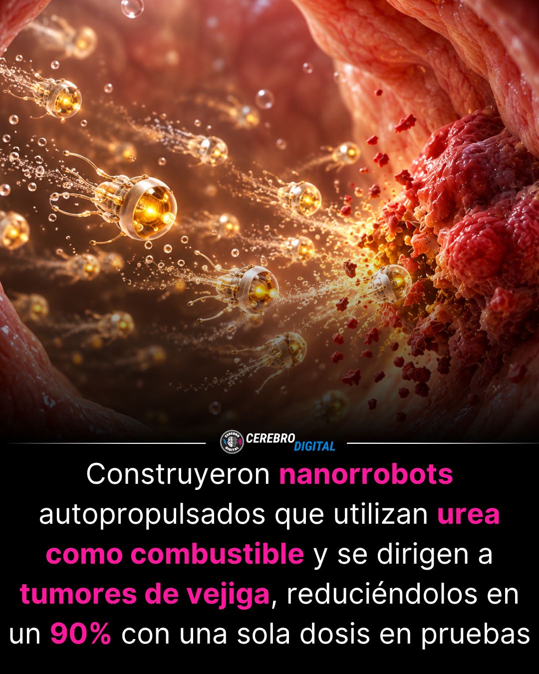 Imagen de la fuente para: Nanobots impulsados por urea reducen tumores de vejiga en ratones